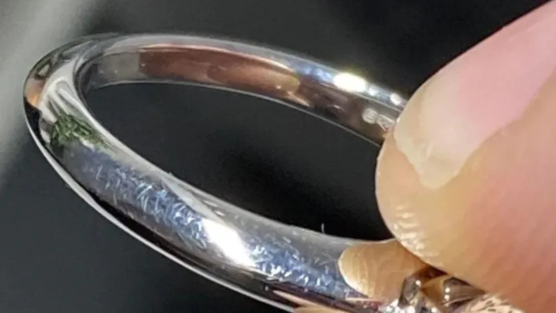 nhẫn cưới bị xước